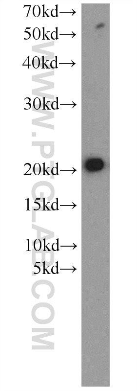 Western Blot (WB) analysis of mouse liver tissue using ITPA Polyclonal antibody (16134-1-AP)