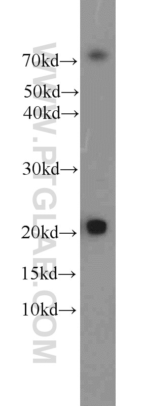 WB analysis of mouse liver using 16134-1-AP