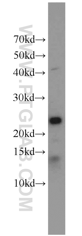 Western Blot (WB) analysis of rat liver tissue using ITPA Polyclonal antibody (16134-1-AP)