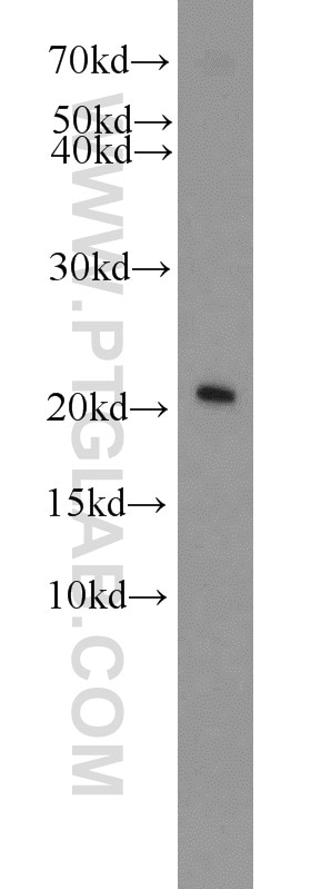 Western Blot (WB) analysis of mouse heart tissue using ITPA Polyclonal antibody (16134-1-AP)