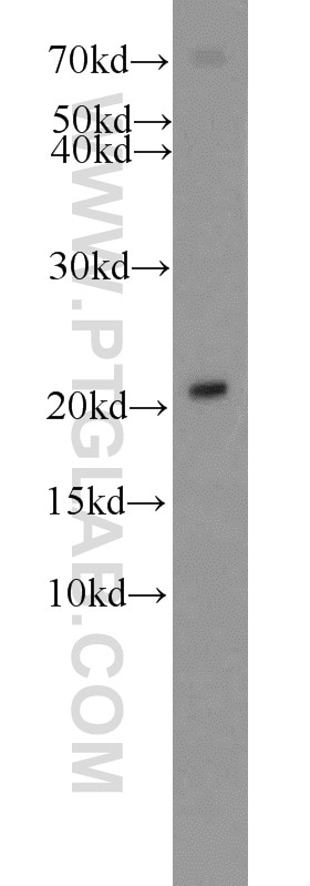 Western Blot (WB) analysis of mouse heart tissue using ITPA Polyclonal antibody (16134-1-AP)