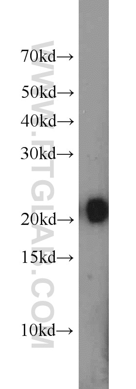 Western Blot (WB) analysis of K-562 cells using ITPA Polyclonal antibody (16134-1-AP)