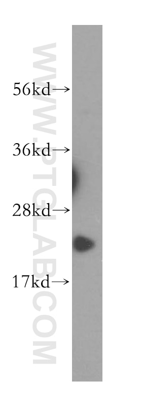 Western Blot (WB) analysis of human liver tissue using ITPA Polyclonal antibody (16134-1-AP)