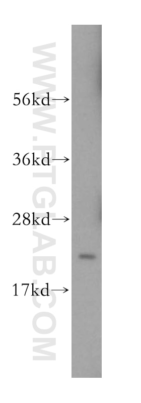 Western Blot (WB) analysis of HeLa cells using ITPA Polyclonal antibody (16134-1-AP)