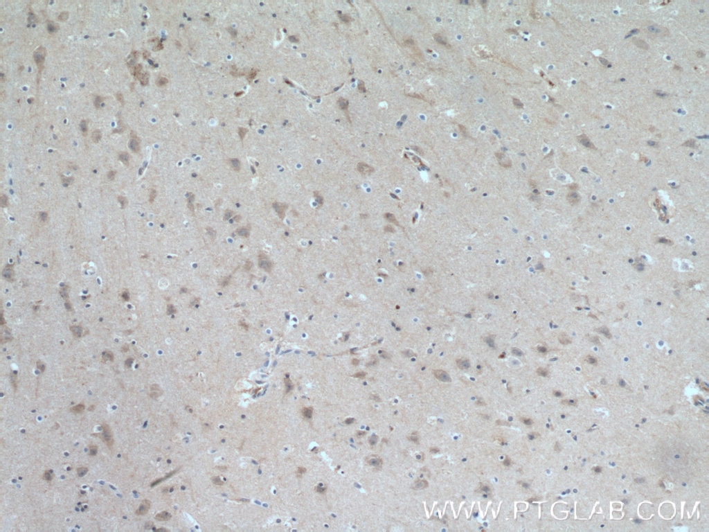 Immunohistochemistry (IHC) staining of human brain tissue using ITPK1 Polyclonal antibody (10568-1-AP)