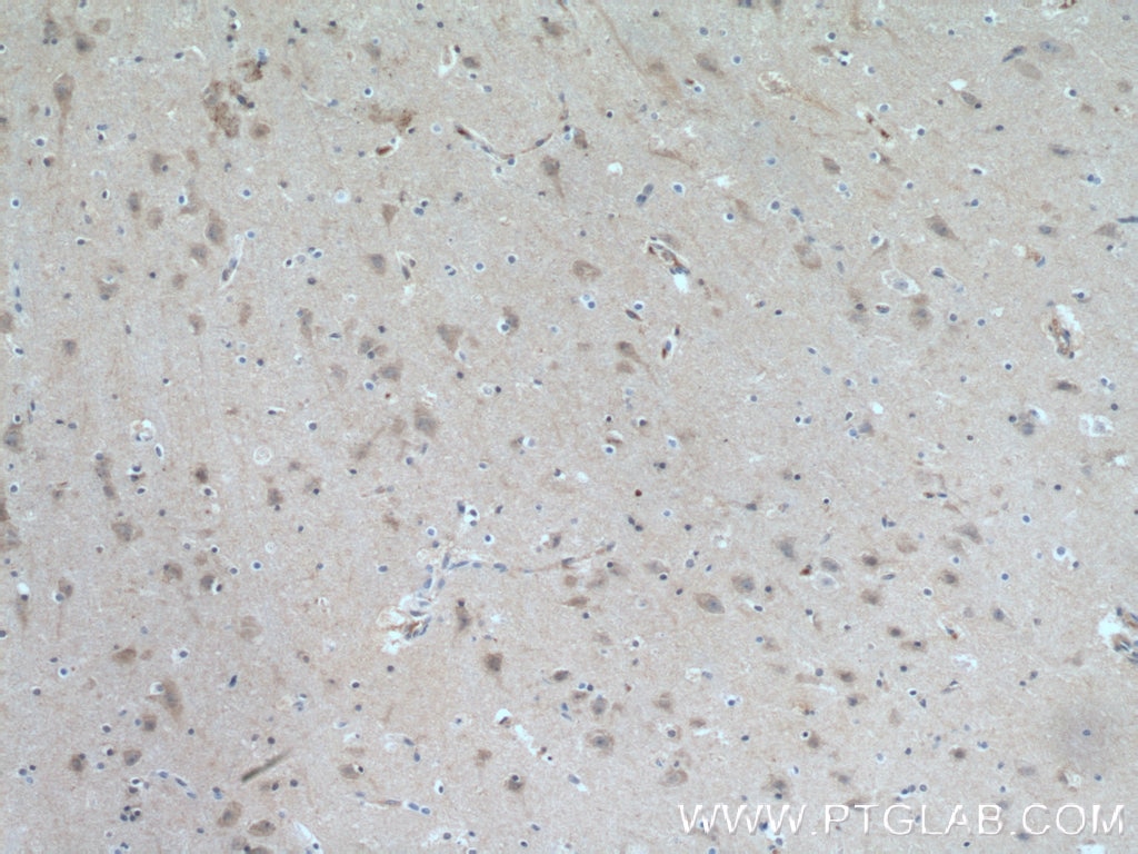 IHC staining of human brain using 10568-1-AP