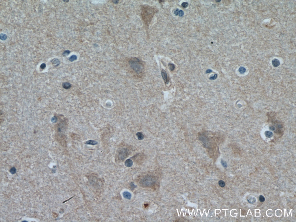 Immunohistochemistry (IHC) staining of human brain tissue using ITPK1 Polyclonal antibody (10568-1-AP)