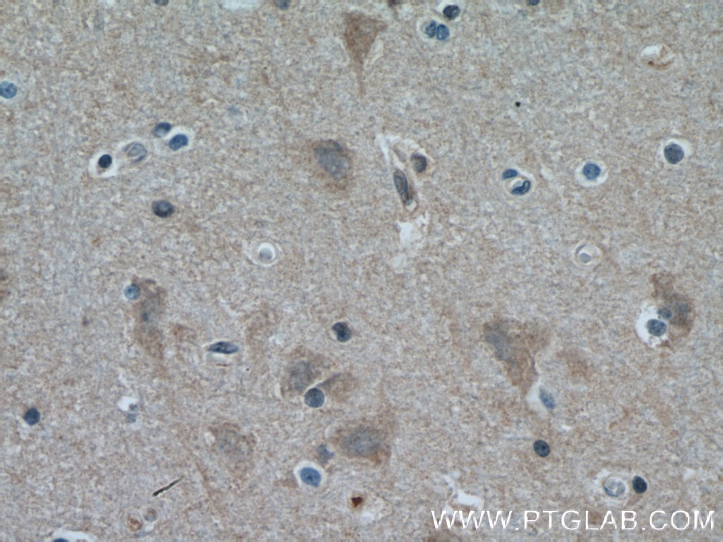 IHC staining of human brain using 10568-1-AP