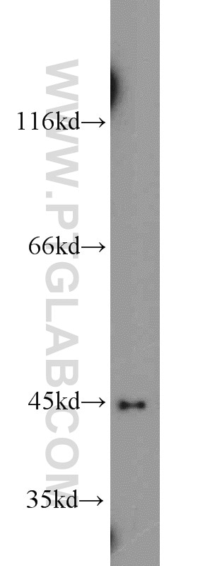 Western Blot (WB) analysis of human brain tissue using ITPK1 Polyclonal antibody (10568-1-AP)