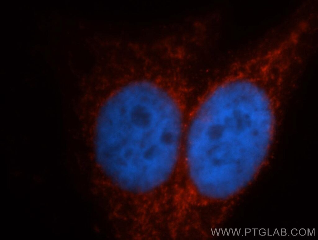 Immunofluorescence (IF) / fluorescent staining of HepG2 cells using ITPKA Polyclonal antibody (14270-1-AP)