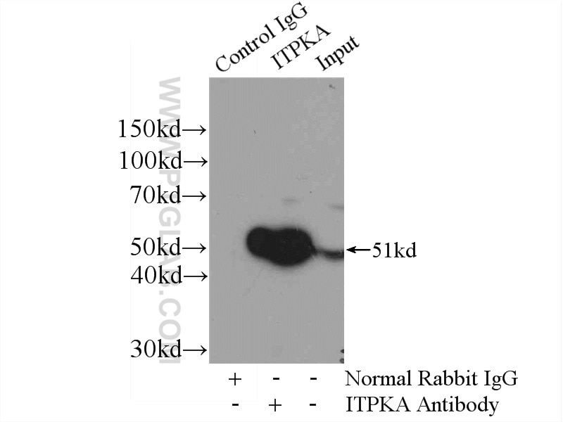 Immunoprecipitation (IP) experiment of mouse brain tissue using ITPKA Polyclonal antibody (14270-1-AP)
