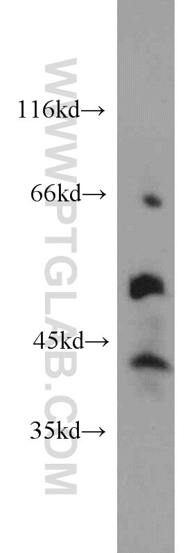 Western Blot (WB) analysis of mouse brain tissue using ITPKA Polyclonal antibody (14270-1-AP)