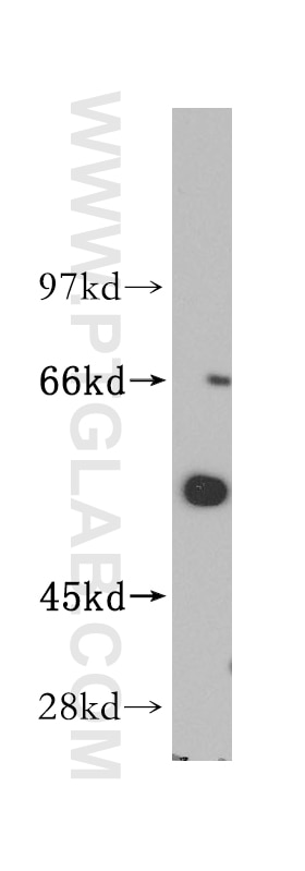 Western Blot (WB) analysis of mouse brain tissue using ITPKA Polyclonal antibody (14270-1-AP)