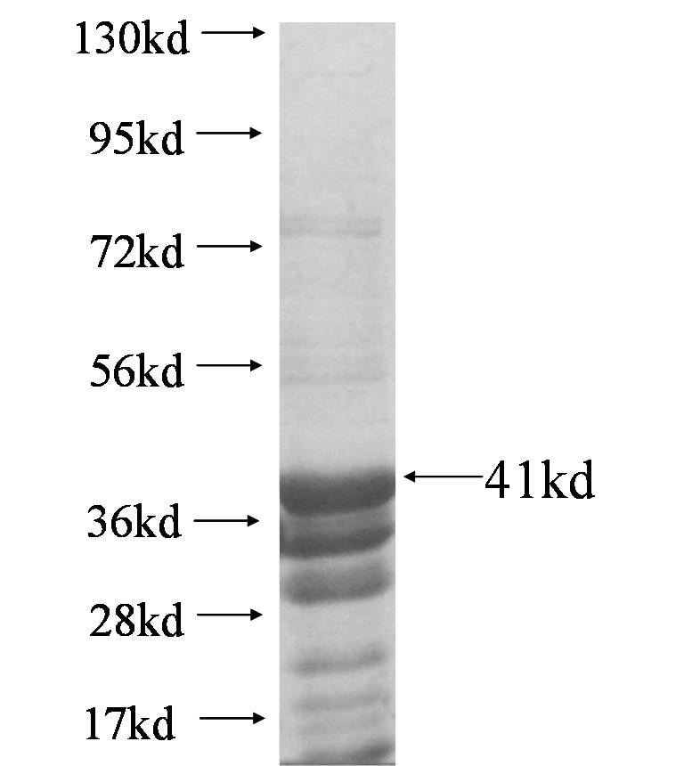 ITPKA fusion protein Ag5988 SDS-PAGE