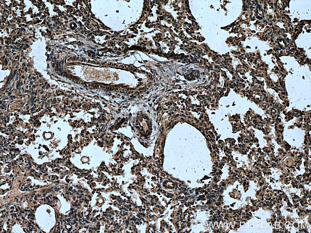 IHC staining of human lung using 12816-1-AP