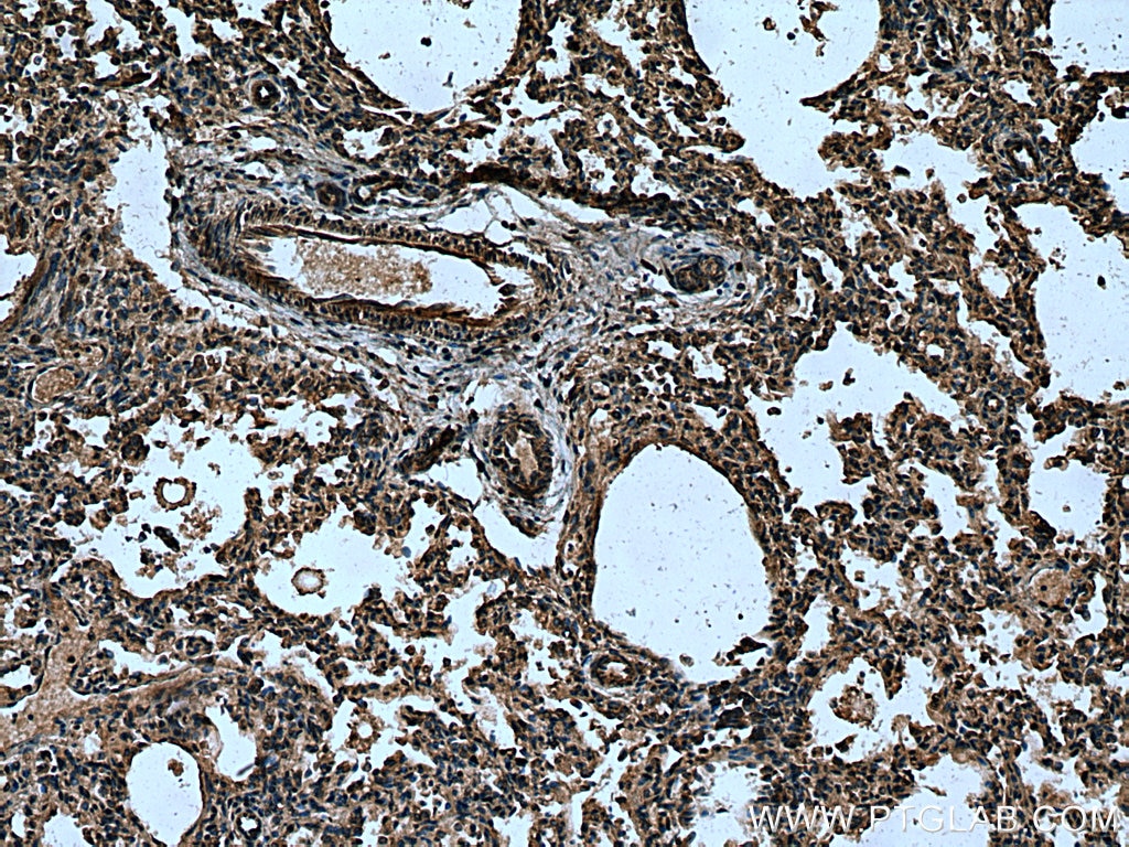 Immunohistochemistry (IHC) staining of human lung tissue using ITPKB Polyclonal antibody (12816-1-AP)