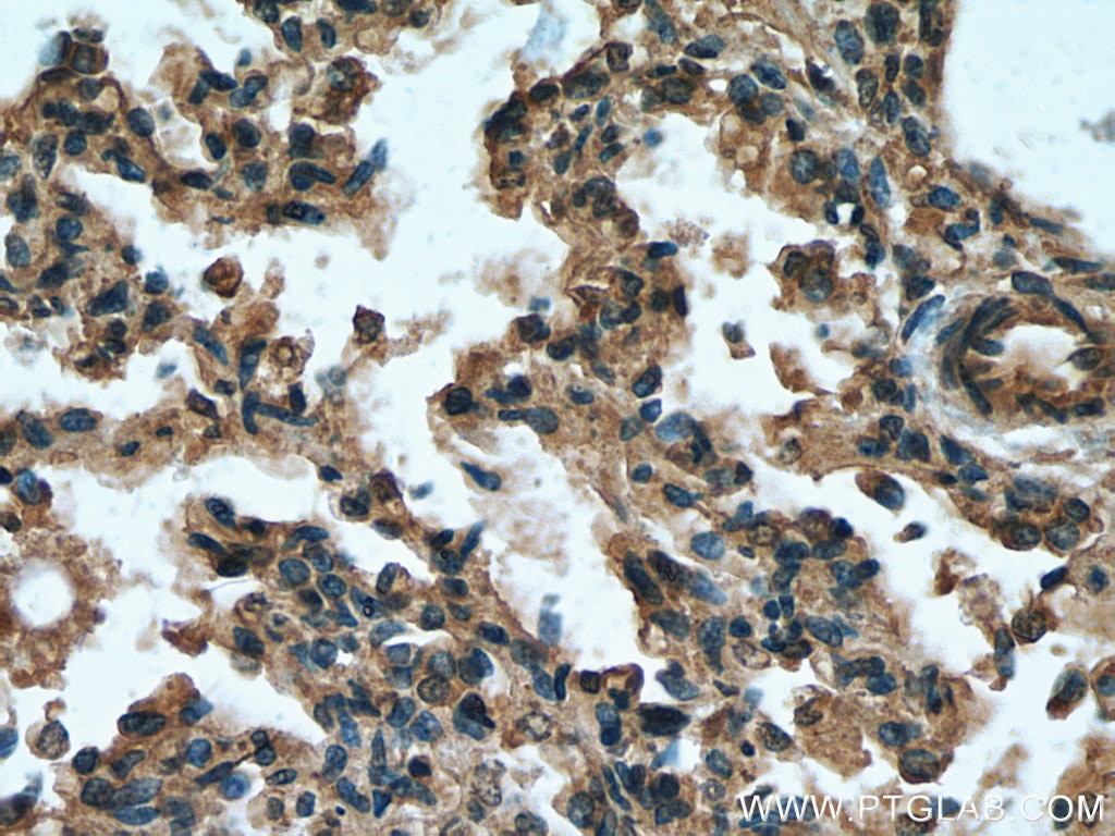 Immunohistochemistry (IHC) staining of human lung tissue using ITPKB Polyclonal antibody (12816-1-AP)
