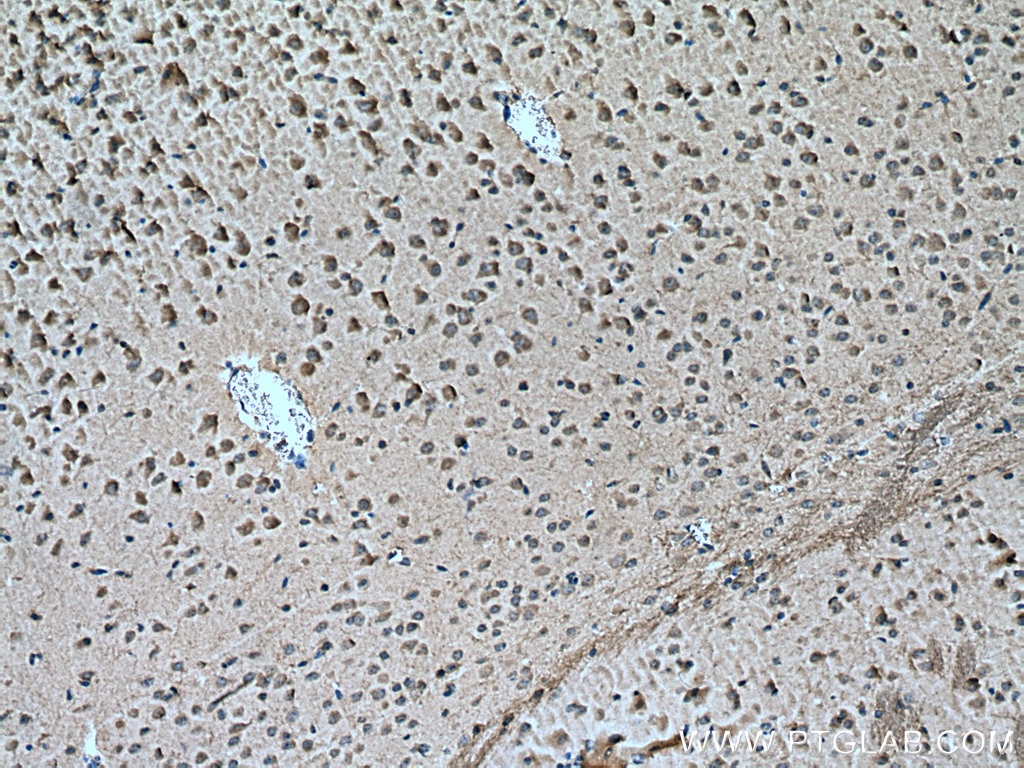 Immunohistochemistry (IHC) staining of mouse brain tissue using ITPKB Polyclonal antibody (12816-1-AP)
