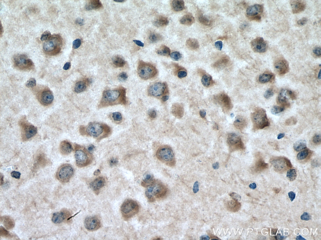 Immunohistochemistry (IHC) staining of mouse brain tissue using ITPKB Polyclonal antibody (12816-1-AP)