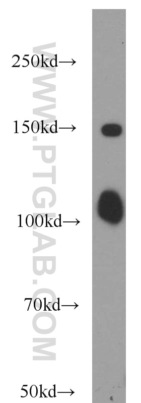 Western Blot (WB) analysis of mouse thymus tissue using ITPKB Polyclonal antibody (12816-1-AP)