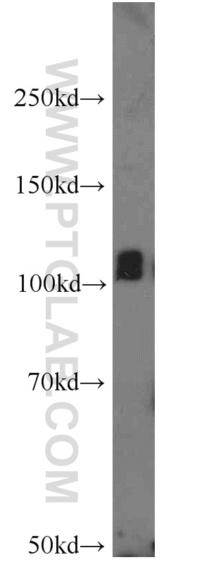 Western Blot (WB) analysis of mouse brain tissue using ITPKB Polyclonal antibody (12816-1-AP)