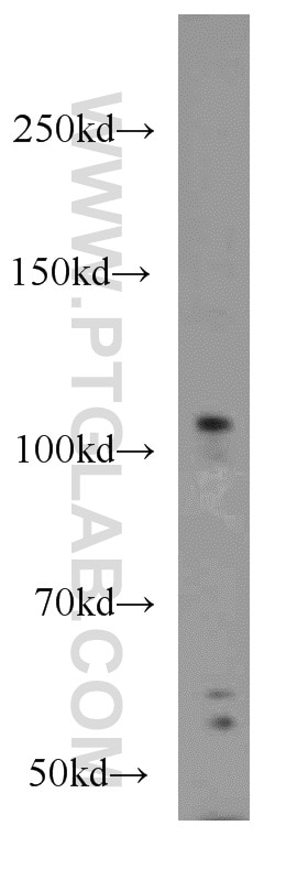 Western Blot (WB) analysis of mouse brain tissue using ITPKB Polyclonal antibody (12816-1-AP)