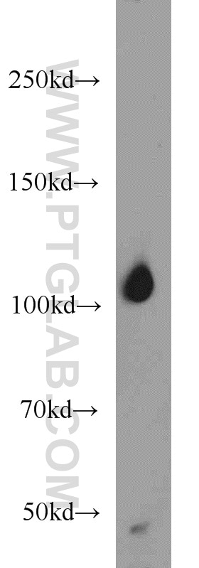 Western Blot (WB) analysis of mouse lung tissue using ITPKB Polyclonal antibody (12816-1-AP)