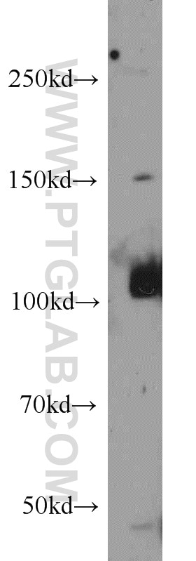 Western Blot (WB) analysis of mouse lung tissue using ITPKB Polyclonal antibody (12816-1-AP)