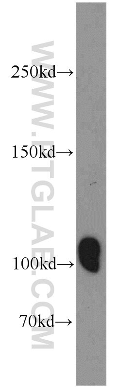 Western Blot (WB) analysis of rat brain tissue using ITPKB Polyclonal antibody (12816-1-AP)