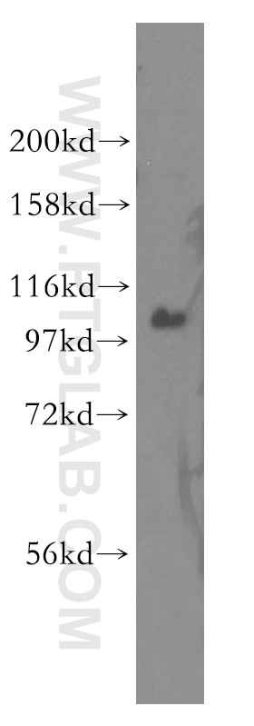 Western Blot (WB) analysis of K-562 cells using ITPKB Polyclonal antibody (12816-1-AP)