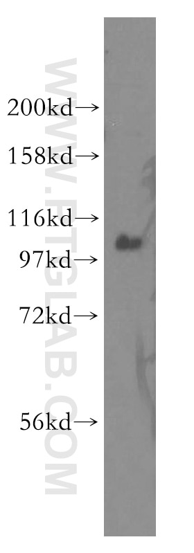 WB analysis of K-562 using 12816-1-AP