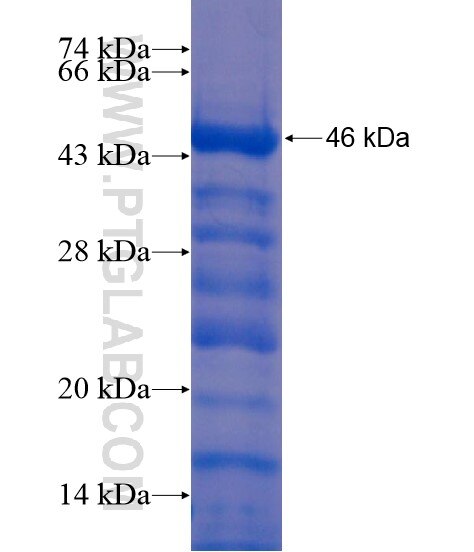 ITPKB fusion protein Ag21362 SDS-PAGE