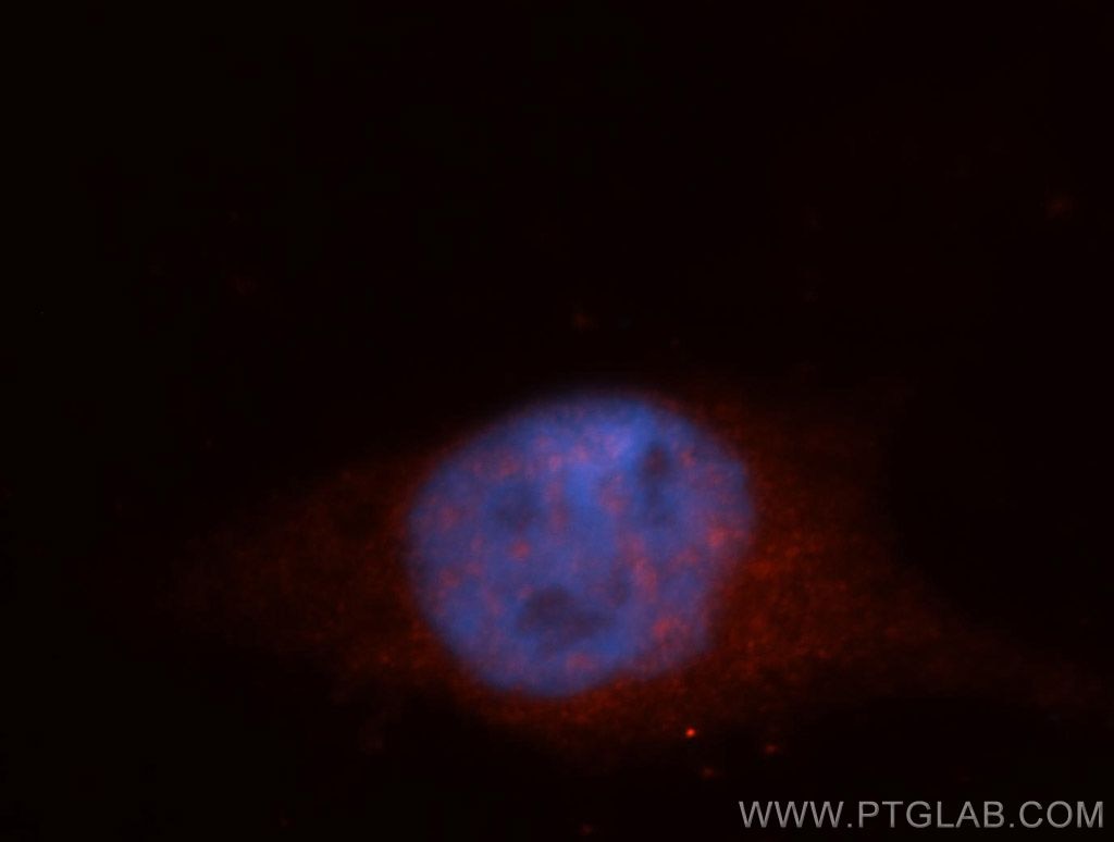 Immunofluorescence (IF) / fluorescent staining of HepG2 cells using ITPKC Polyclonal antibody (14267-1-AP)