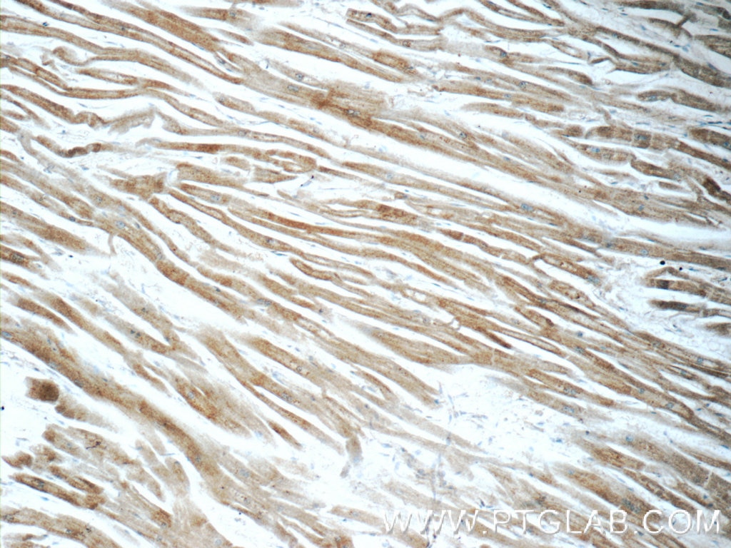 Immunohistochemistry (IHC) staining of human heart tissue using ITPKC Polyclonal antibody (14267-1-AP)