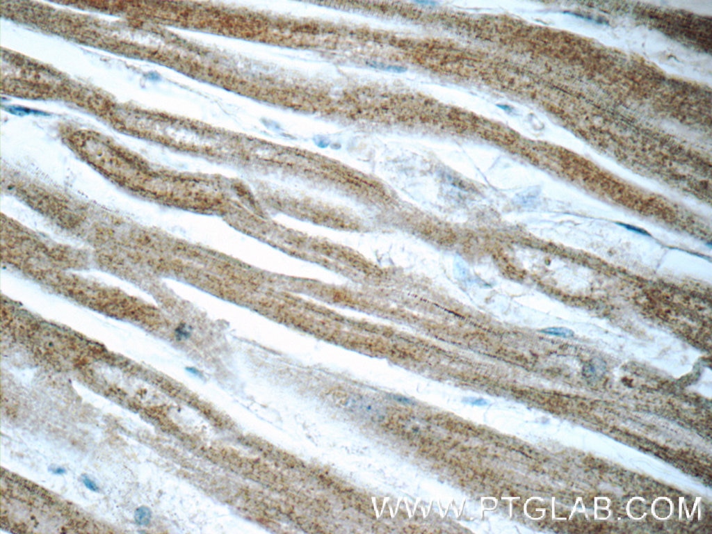 Immunohistochemistry (IHC) staining of human heart tissue using ITPKC Polyclonal antibody (14267-1-AP)