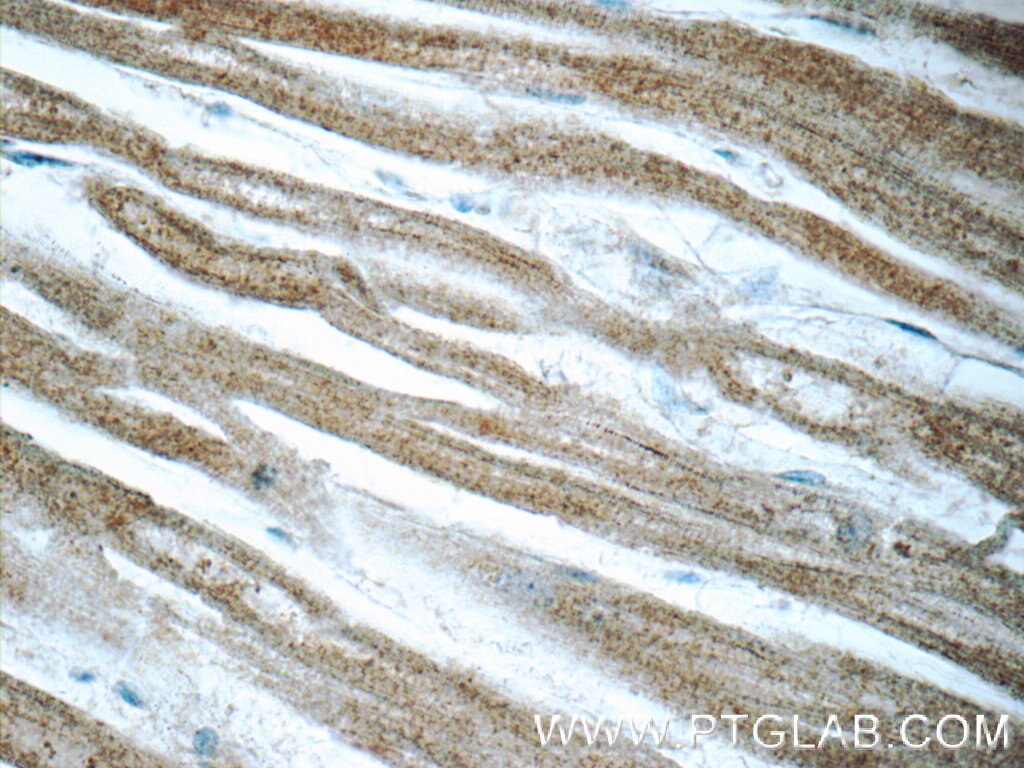 IHC staining of human heart using 14267-1-AP