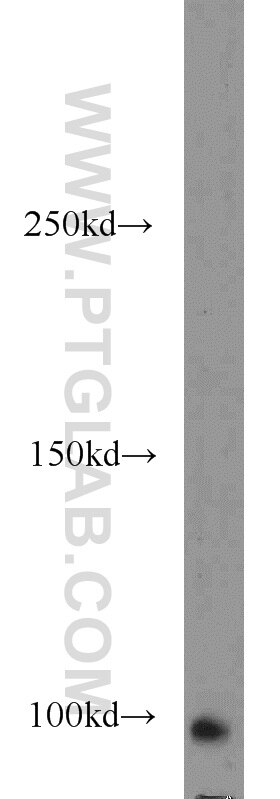 Western Blot (WB) analysis of human heart tissue using ITPKC Polyclonal antibody (14267-1-AP)