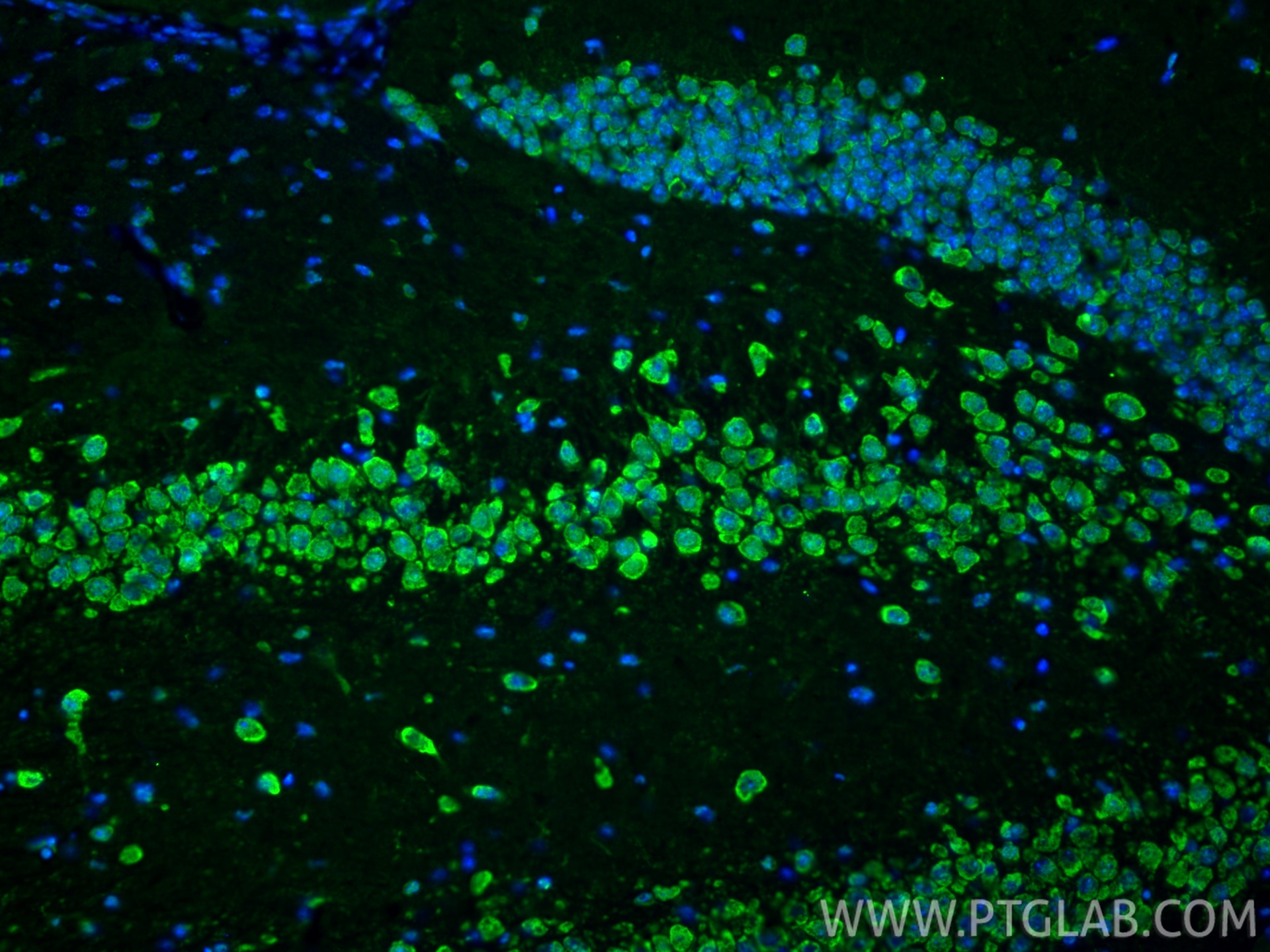 Immunofluorescence (IF) / fluorescent staining of mouse brain tissue using ITPR1-specific Polyclonal antibody (19962-1-AP)