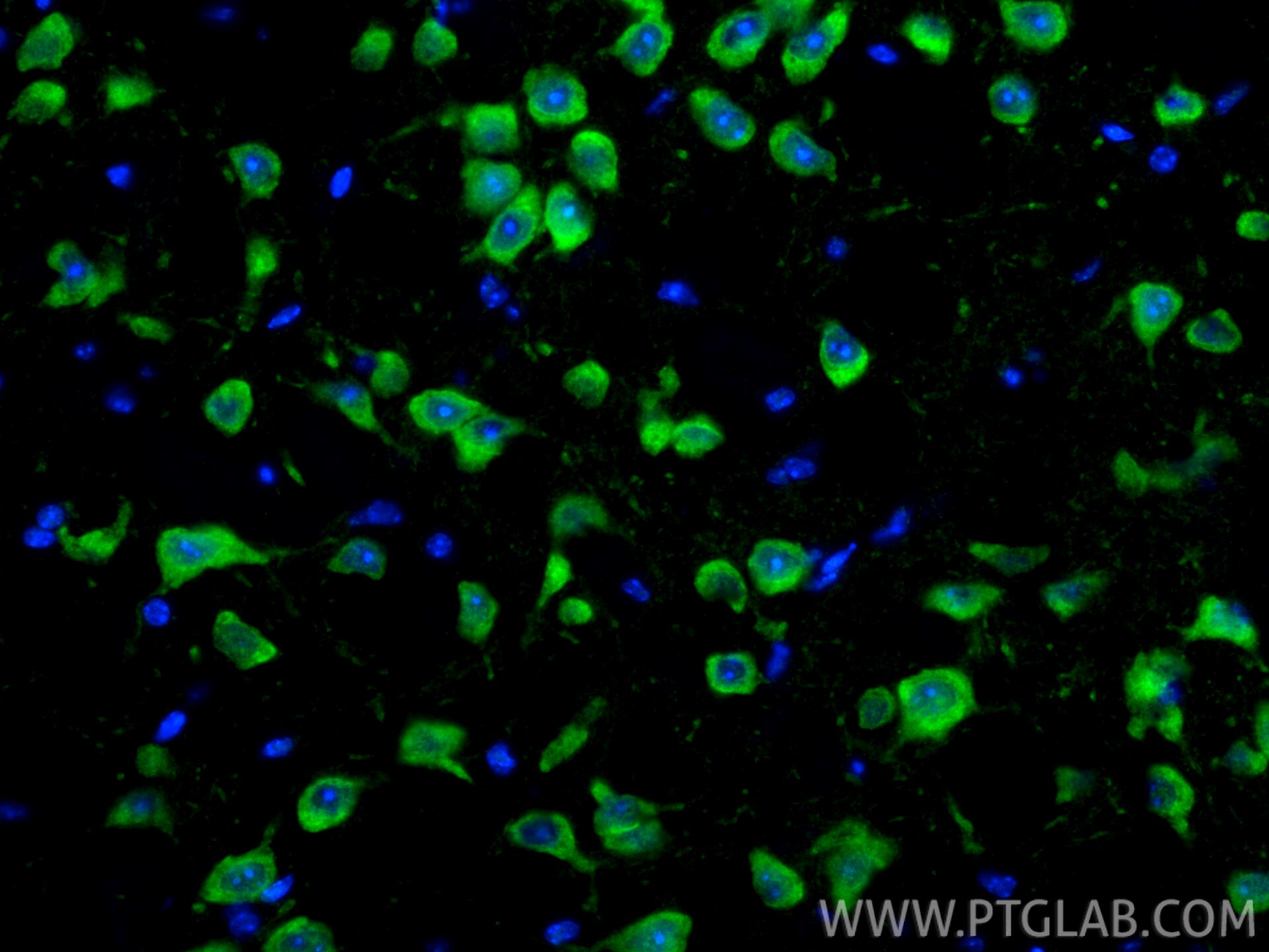 Immunofluorescence (IF) / fluorescent staining of mouse brain tissue using ITPR1-specific Polyclonal antibody (19962-1-AP)