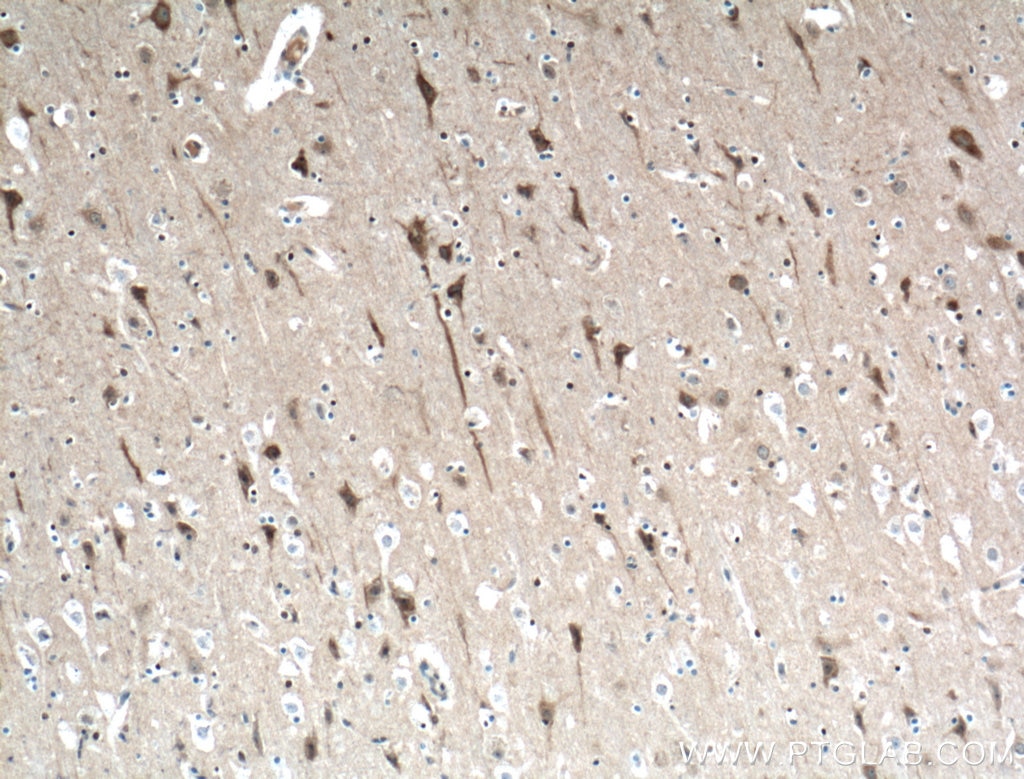 Immunohistochemistry (IHC) staining of human brain tissue using ITPR1-specific Polyclonal antibody (19962-1-AP)