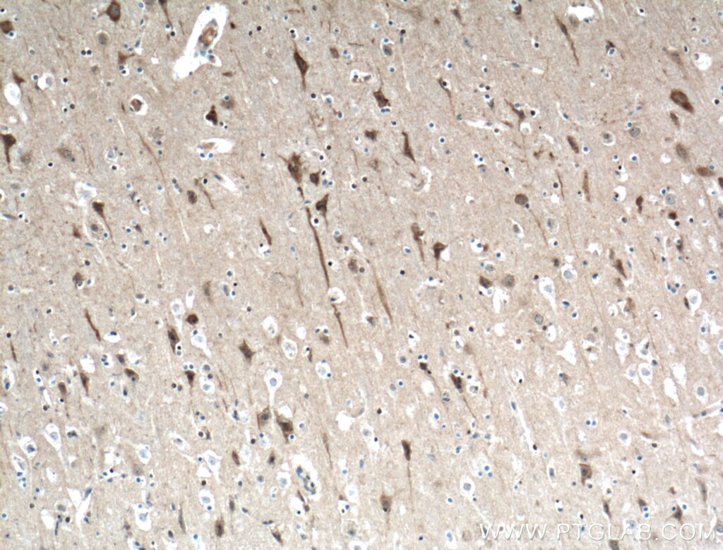 Immunohistochemistry (IHC) staining of human brain tissue using ITPR1-specific Polyclonal antibody (19962-1-AP)