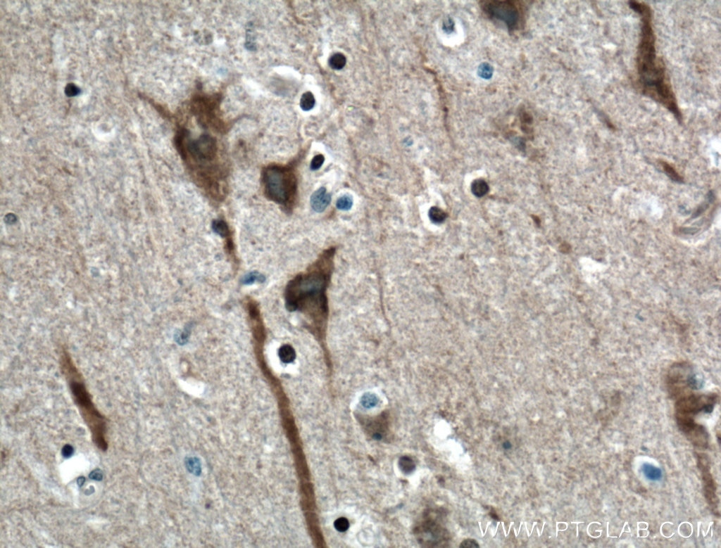 Immunohistochemistry (IHC) staining of human brain tissue using ITPR1-specific Polyclonal antibody (19962-1-AP)