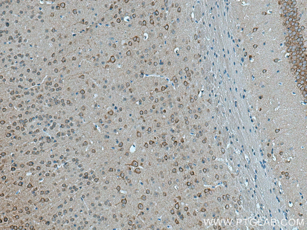 Immunohistochemistry (IHC) staining of mouse brain tissue using ITPR1-specific Polyclonal antibody (19962-1-AP)