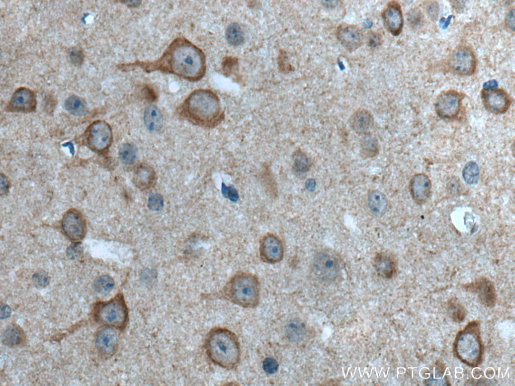 Immunohistochemistry (IHC) staining of mouse brain tissue using ITPR1-specific Polyclonal antibody (19962-1-AP)