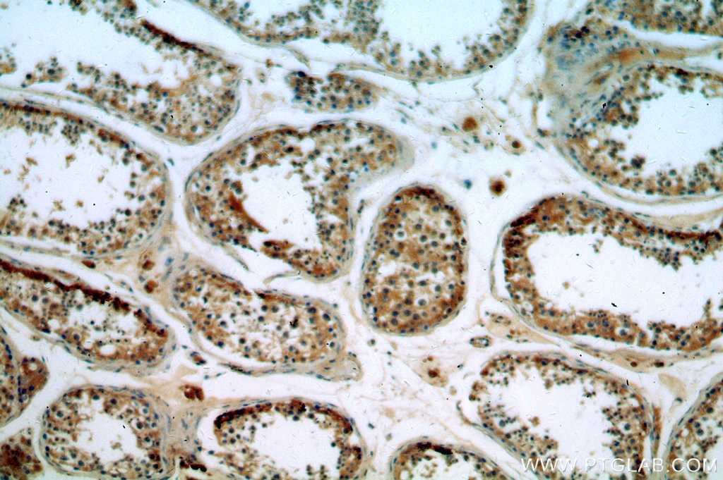 Immunohistochemistry (IHC) staining of human testis tissue using ITPR1-specific Polyclonal antibody (19962-1-AP)