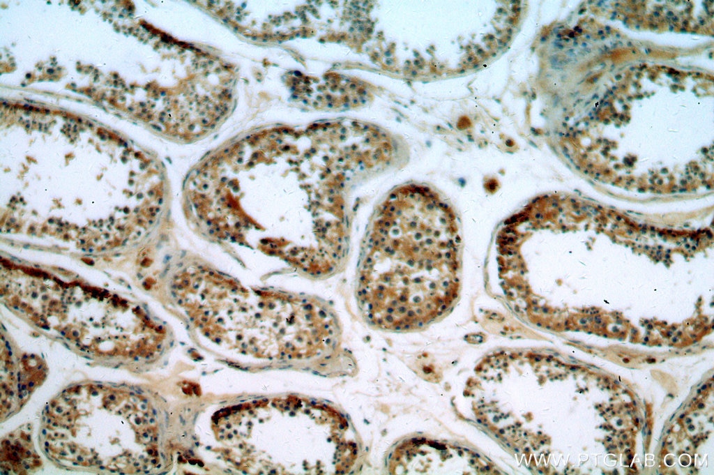 IHC staining of human testis using 19962-1-AP