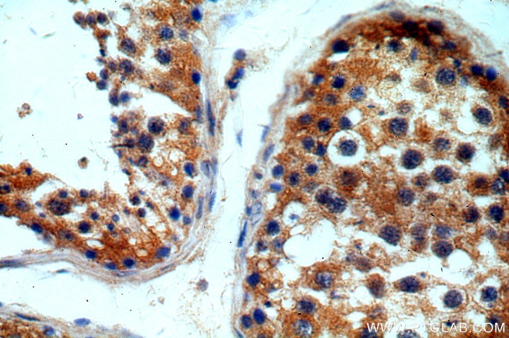 Immunohistochemistry (IHC) staining of human testis tissue using ITPR1-specific Polyclonal antibody (19962-1-AP)