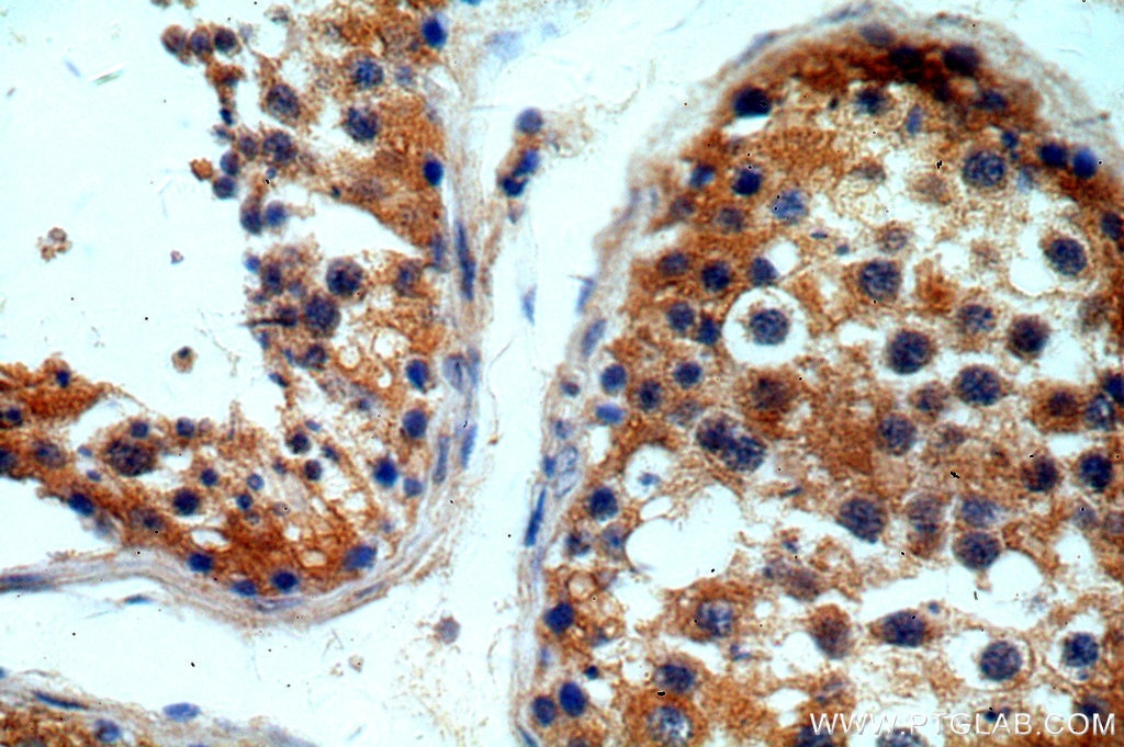 IHC staining of human testis using 19962-1-AP