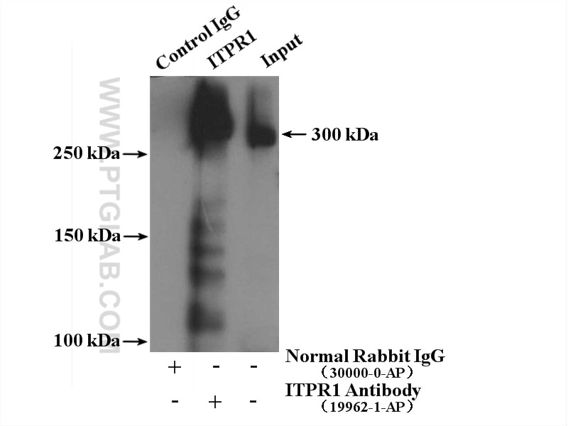 Immunoprecipitation (IP) experiment of mouse brain tissue using ITPR1-specific Polyclonal antibody (19962-1-AP)
