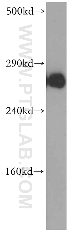 Western Blot (WB) analysis of mouse brain tissue using ITPR1-specific Polyclonal antibody (19962-1-AP)
